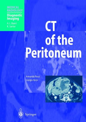 Peritoneum