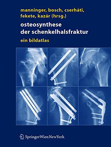 Osteosynthese
