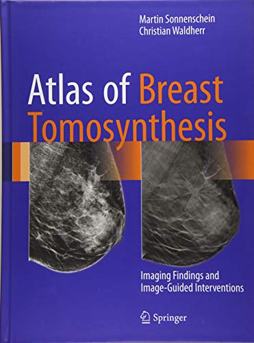 Tomosynthesis