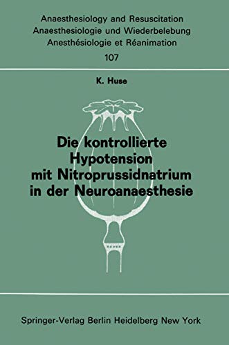 Neuroanaesthesie