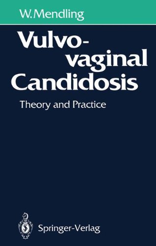 Candidosis