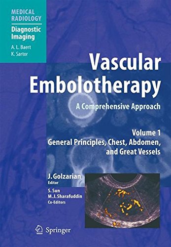 Embolotherapy