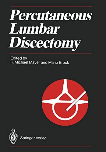 Discectomy