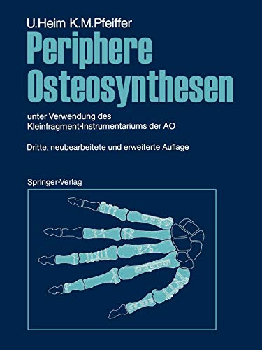 Osteosynthesen