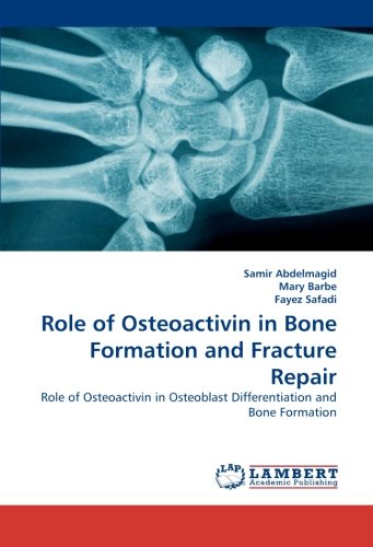 Osteoactivin