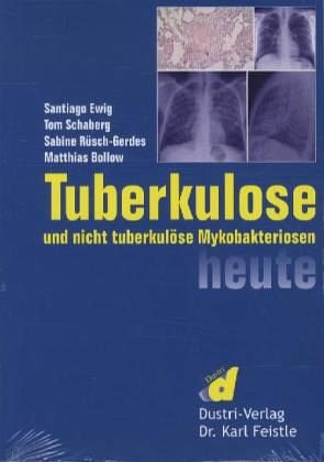 tuberkuloese